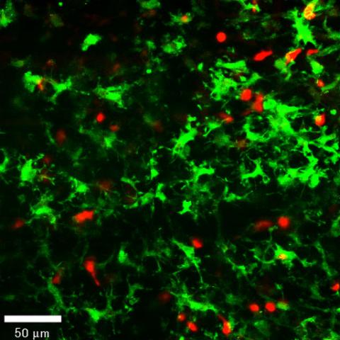 dendritic cells 